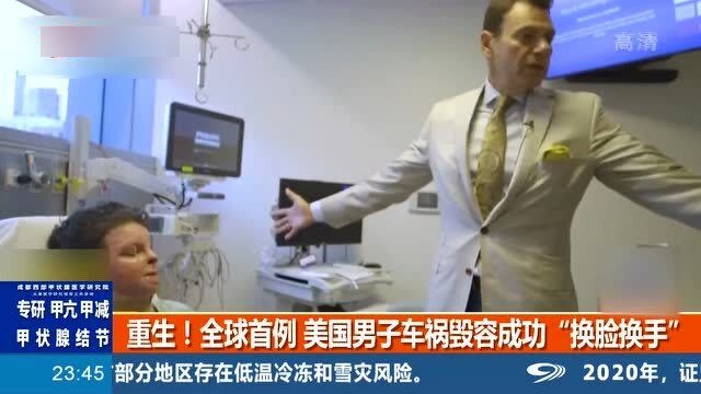 全球首例成功换脸换手男子将结婚——重塑人生，迈向幸福